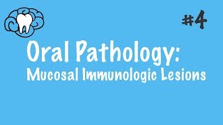 Oral Pathology  Mucosal Immunologic Diseases  INBDE ADAT [upl. by Dorreg125]