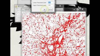 Quantifying Stained Liver Tissue Area Using ImageJ [upl. by Yevette]