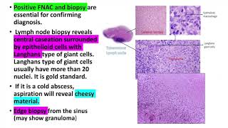 Mesenteric Adenitis vs Appendicitis  How to tell the difference [upl. by Supen483]