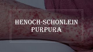 HenochSchonlein Purpura  purple rash on skin vasculitis [upl. by Asirehc]