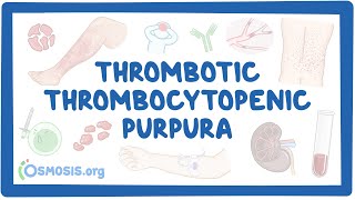 Thrombotic thrombocytopenic purpura NORD [upl. by Hirai]