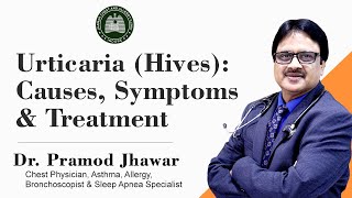 Urticaria Hives  CausesSymptoms amp Treatment [upl. by Isnam649]