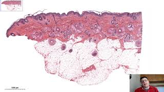 Histologia da Pele [upl. by Mcfadden]