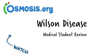 Wilson Disease  Clinical Presentation [upl. by Culbert]