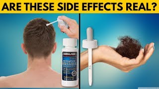 REAL TRUTH About Minoxidil Side Effects [upl. by Akcirret]