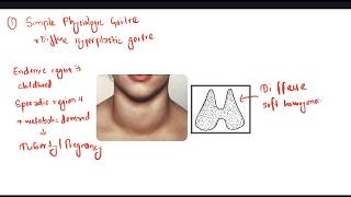 Simple Goitre  Thyroid [upl. by Gilus]