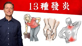 13種發炎消炎自然療法柏格醫生 Dr Berg [upl. by Gnouh]