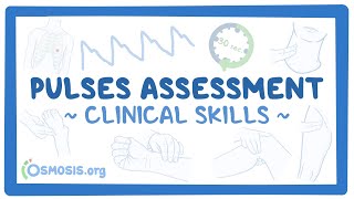 Clinical Skills Pulses assessment [upl. by Rafaelita]