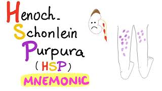 HenochSchönlein Purpura HSP  with a Mnemonic [upl. by Bega127]