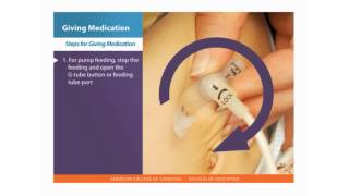 Percutaneous Endoscopic GastrostomyJejunostomy Tube Insertion [upl. by Beale]