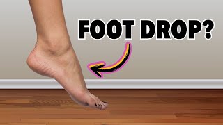 Top 3 Exercises For Foot Drop [upl. by Nancey]