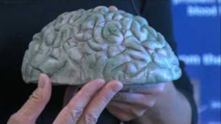 Deep Brain Stimulation How It Works [upl. by Gar]