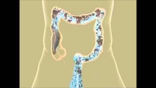 How to Cleanse Your Colon Naturally  Dr Josh Axe [upl. by Werdn770]