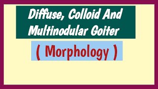 Diffuse Colloid And Multinodular Goiter  Pathology Morphology [upl. by Gallager256]